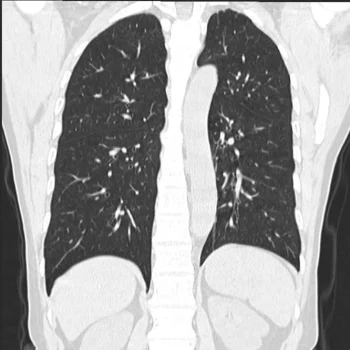 MBH_300-PLUS-8-RESPIRATORIO