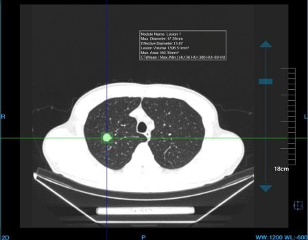 MBH_300 PLUS 9 ONCOLOGIA